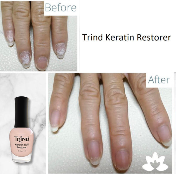 Trind Keratin Nail Restorer - Bare Nail Finish Strengthener - Formaldehyde Free